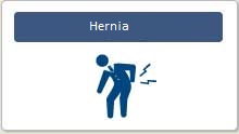 Hernia