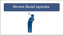 Severe facial injuries